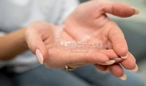 Closeup of patient holding clear aligner
