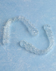 Invisalign clear aligners 