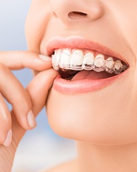 woman wearing invisalign