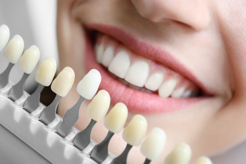 Color-matching a woman’s smile for cosmetic dentistry