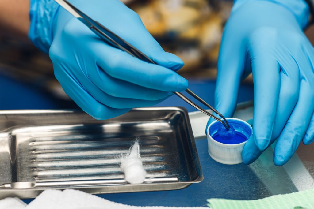 Blue-gloved hands scooping fluoride to apply to patient